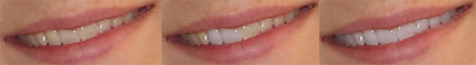 digital teeth whitener